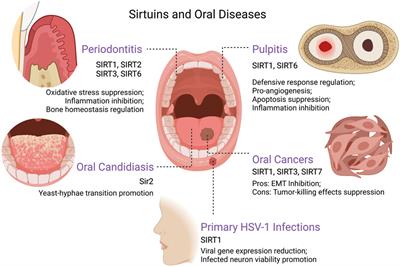Oxidative stress and inflammation regulation of sirtuins: New insights into common oral diseases